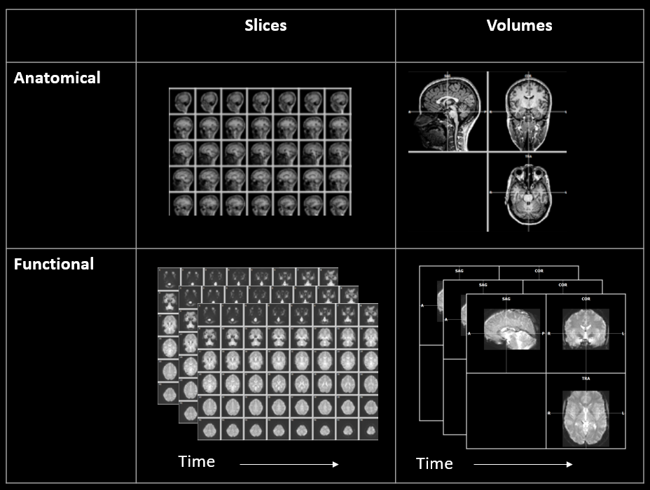 Images of functional and anatomical MRI scans