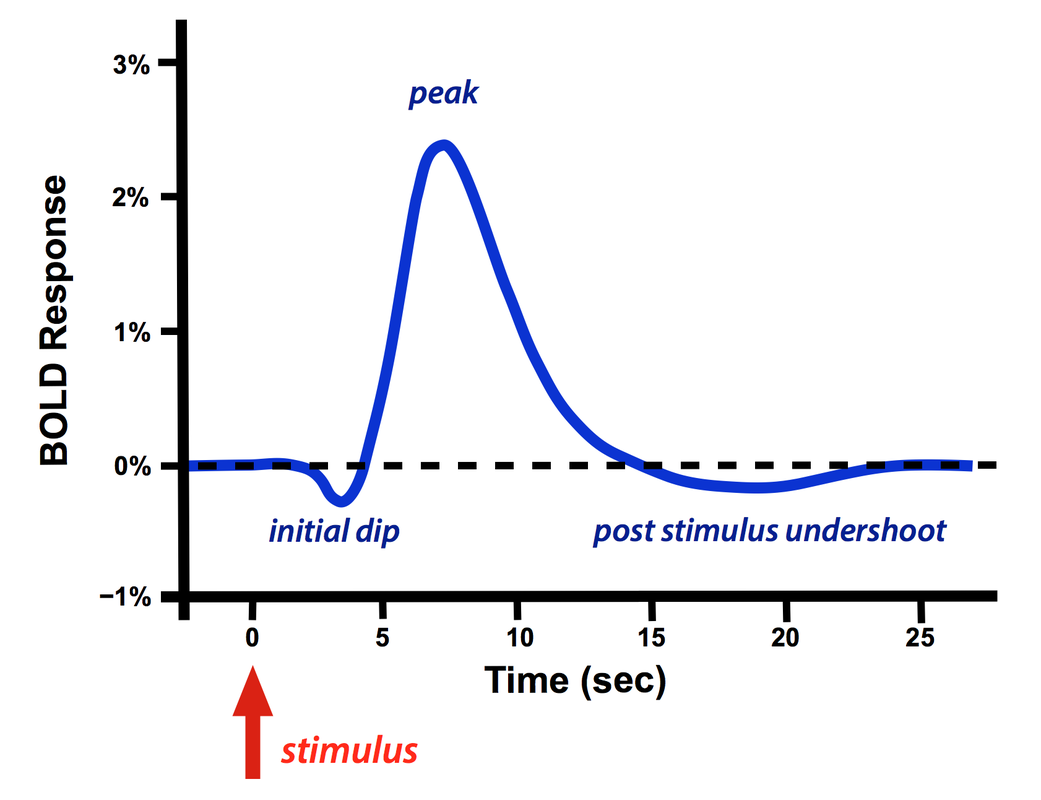 Plot showing the HRF in a BOLD Response % vs. Time(sec) graph